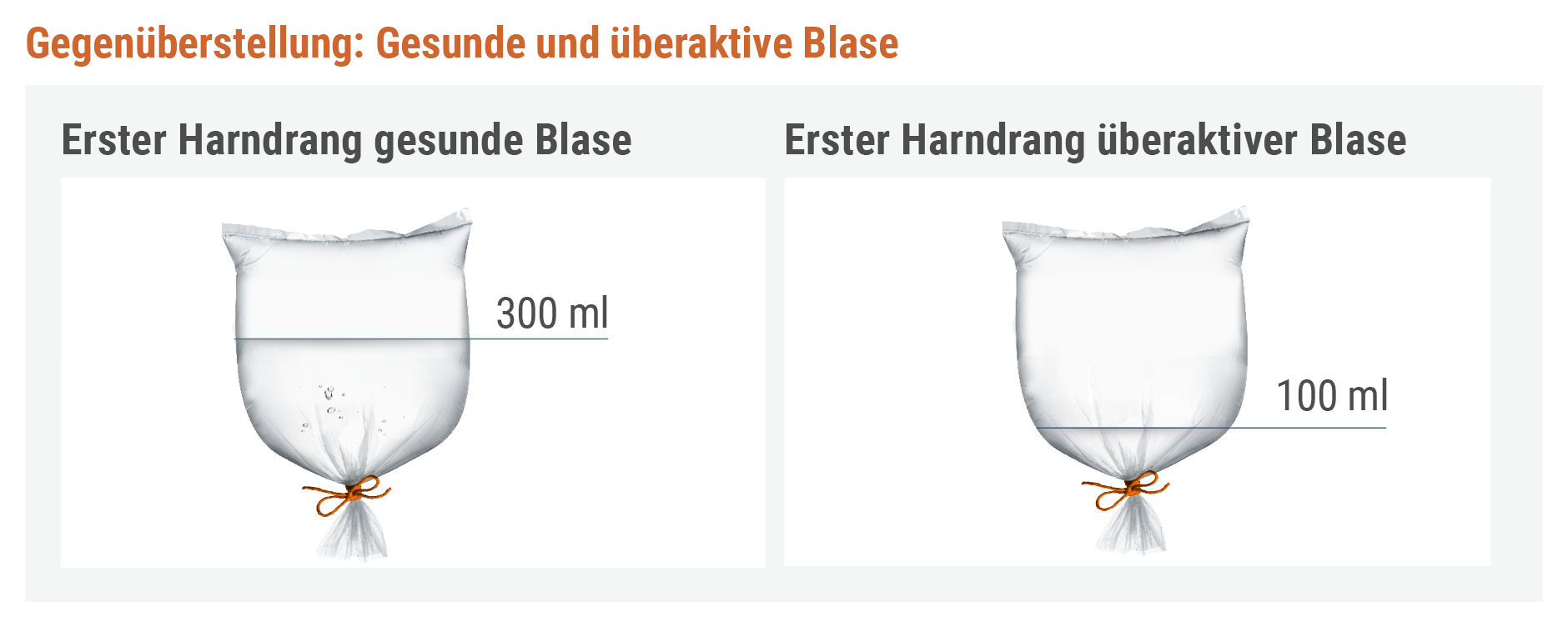 ast_blase-ok_Verstehen_So-funktioniert-die-Blase_4